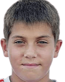 لوبوس برازينكا